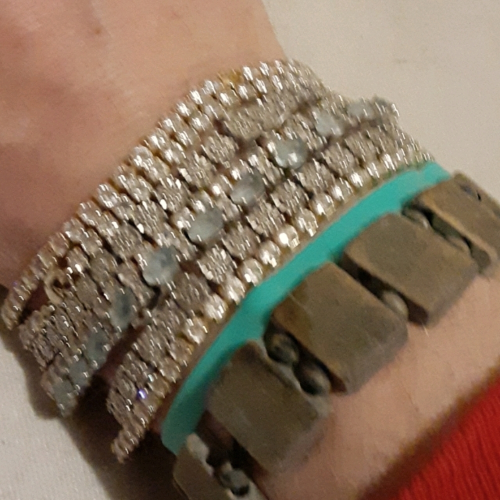 My arm